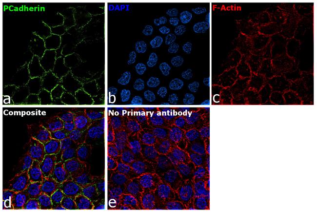 P-cadherin Antibody in Immunocytochemistry (ICC/IF)