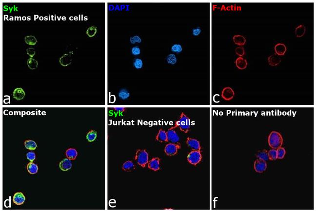 Syk Antibody in Immunocytochemistry (ICC/IF)