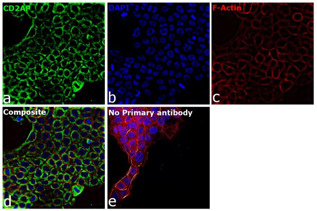 CD2AP Antibody in Immunocytochemistry (ICC/IF)