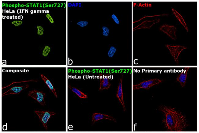 Phospho-STAT1 (Ser727) Antibody in Immunocytochemistry (ICC/IF)