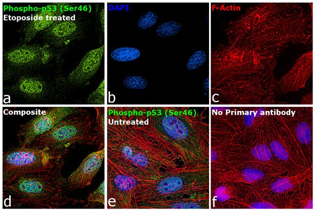 Phospho-p53 (Ser46) Antibody in Immunocytochemistry (ICC/IF)