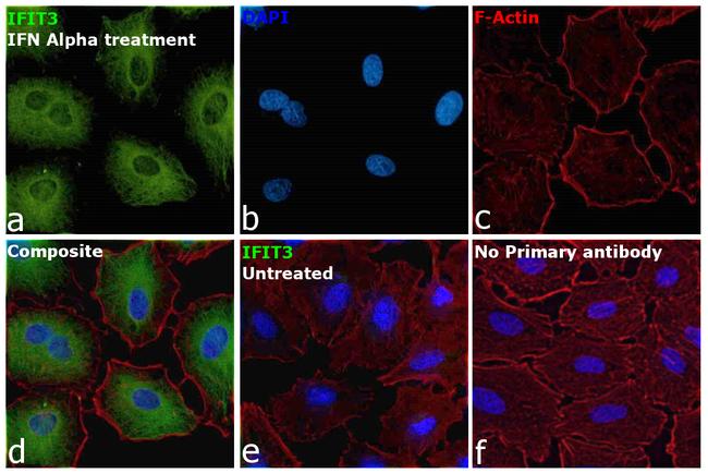 IFIT3 Antibody in Immunocytochemistry (ICC/IF)