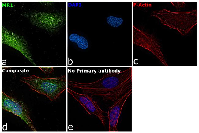 MR1 Antibody in Immunocytochemistry (ICC/IF)