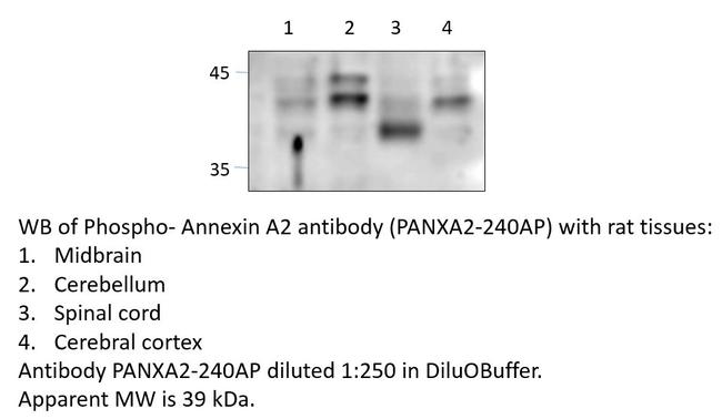 Phospho-Annexin A2 (Ser12, Thr18) Antibody in Western Blot (WB)