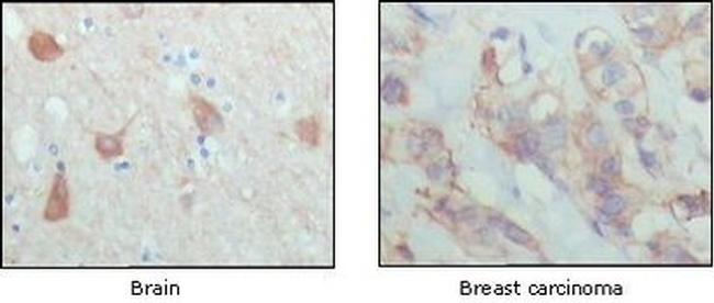 PAR4 Antibody in Immunohistochemistry (Paraffin) (IHC (P))