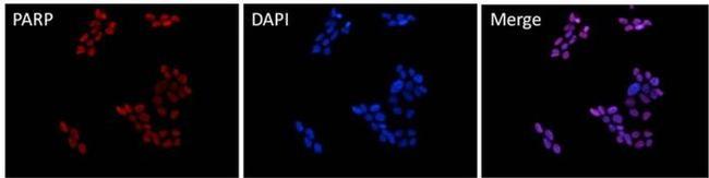 PARP1 Antibody in Immunocytochemistry (ICC/IF)