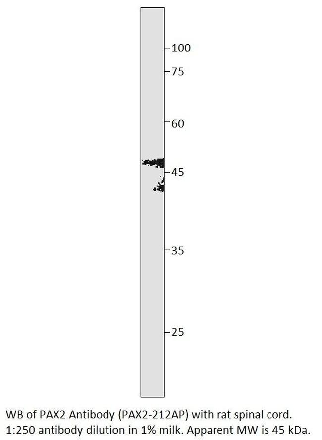 PAX2 Antibody in Western Blot (WB)