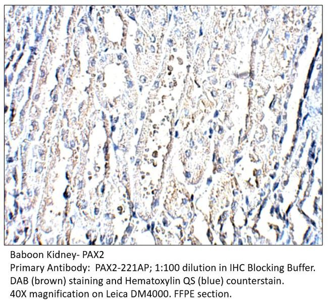 Pax2 Antibody in Immunohistochemistry (IHC)