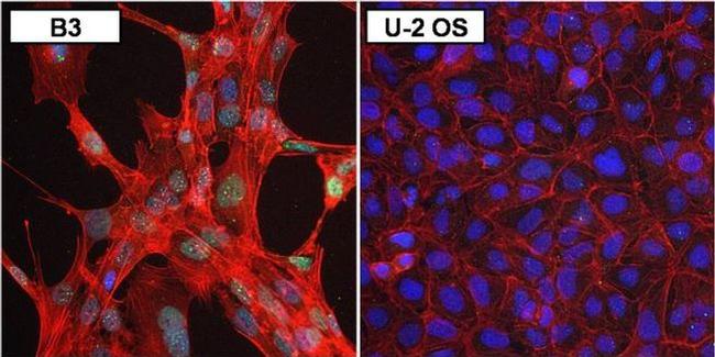 PAX6 Antibody in Immunocytochemistry (ICC/IF)