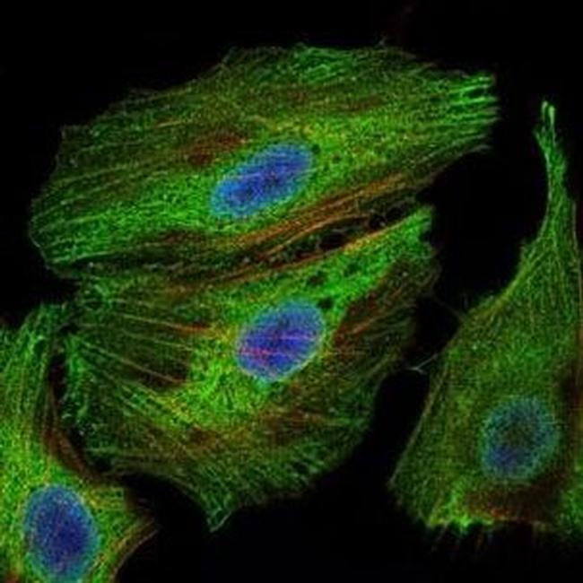 PBK Antibody in Immunocytochemistry (ICC/IF)