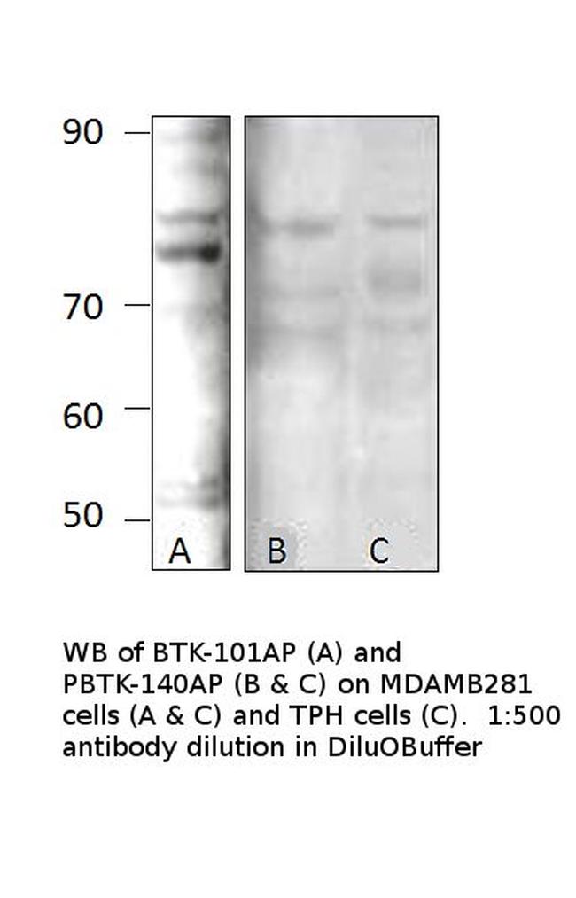 Phospho-BTK (Tyr551) Antibody in Western Blot (WB)