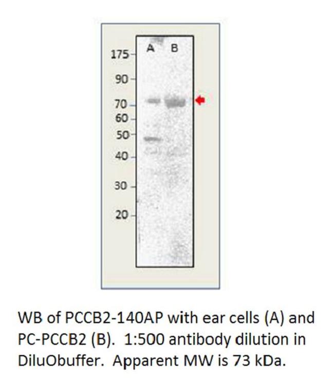 Phospho-CACNB2 (Ser621) Antibody in Western Blot (WB)