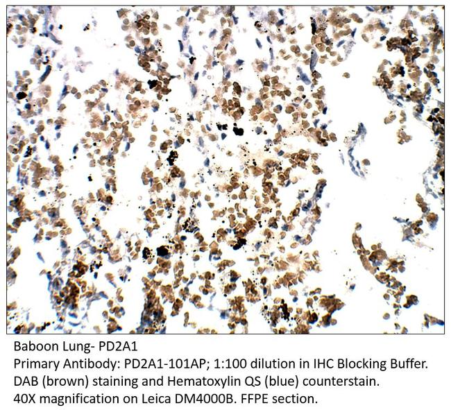 PDE2A1 Antibody in Immunohistochemistry (IHC)