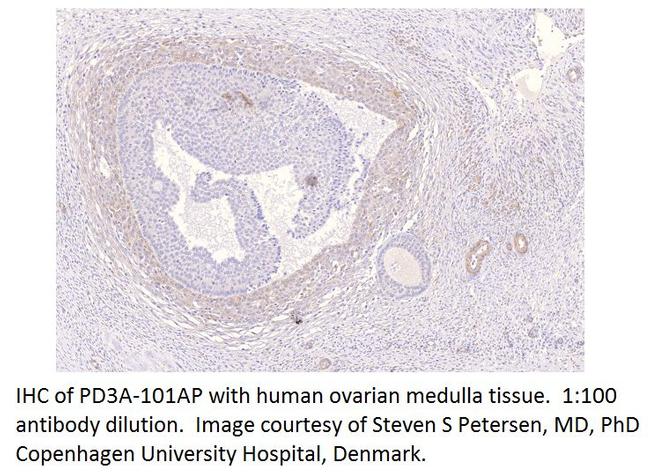 PDE3A Antibody in Immunohistochemistry (IHC)