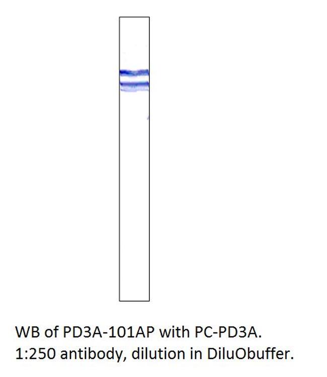 PDE3A Antibody in Western Blot (WB)