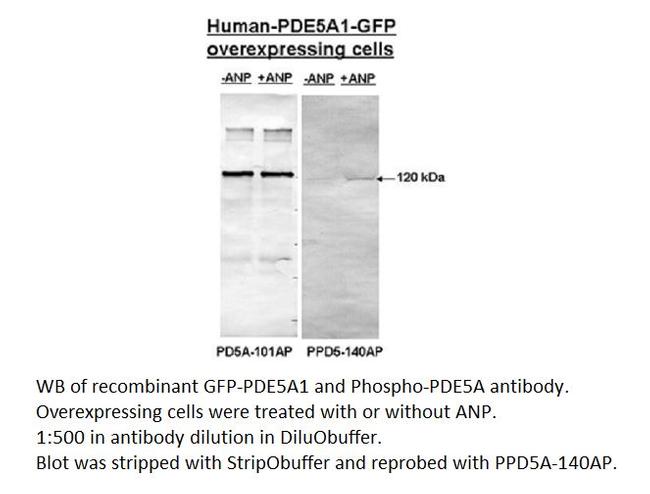 PDE5A Antibody in Western Blot (WB)