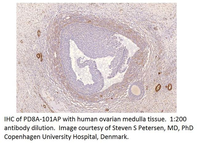 PDE8A Antibody in Immunohistochemistry (IHC)