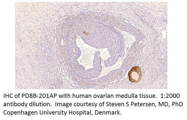 PDE8B Antibody in Immunohistochemistry (IHC)