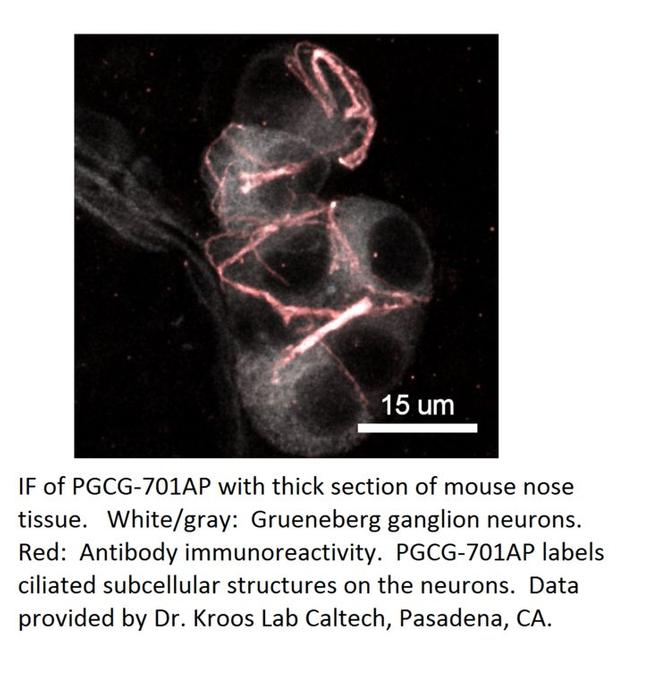 PGCG Antibody in Immunohistochemistry (IHC)