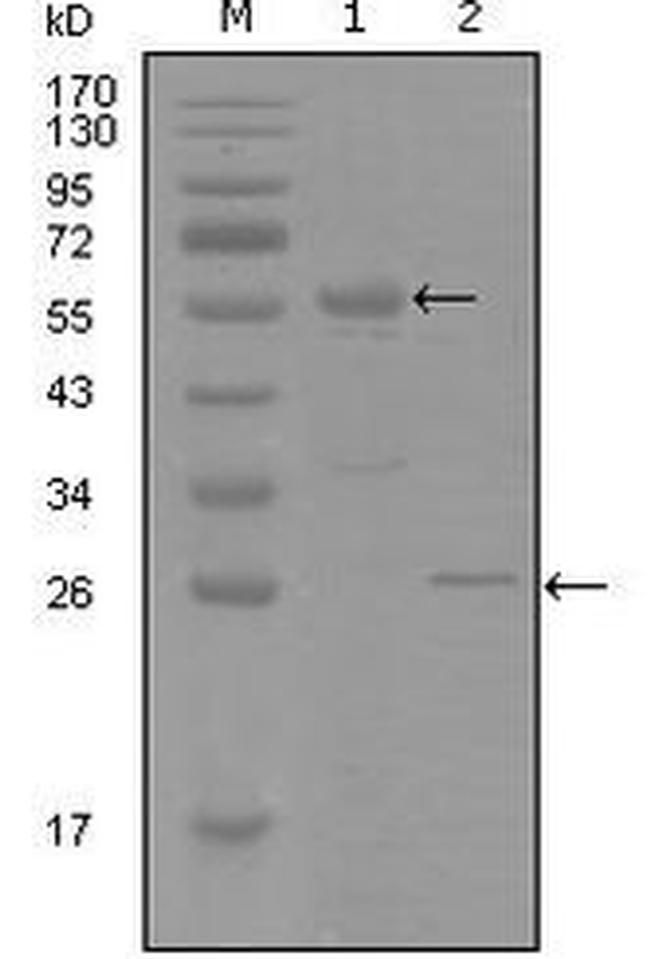 Progesterone Receptor Antibody in Western Blot (WB)