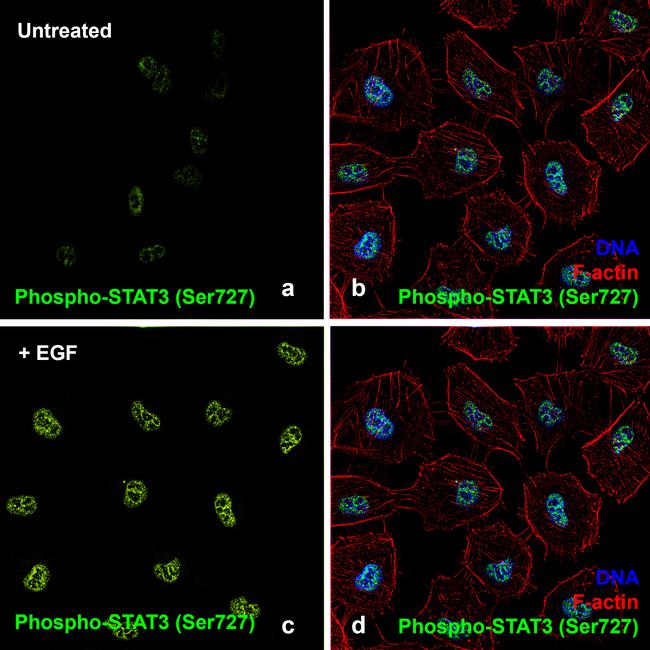 Human EGF Protein in Functional Assay (Functional)