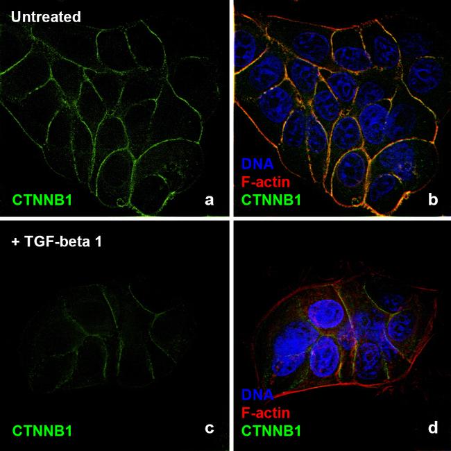 Human TGF-beta 1 Protein in Functional Assay (Functional)