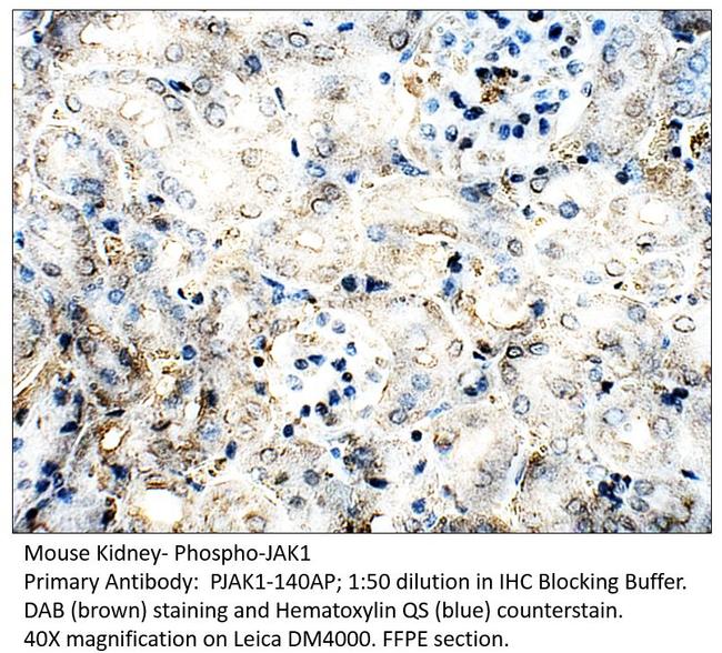 Phospho-JAK1 (Tyr1034, Tyr1035) Antibody in Immunohistochemistry (IHC)