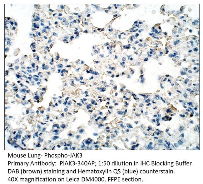 Phospho-JAK3 (Tyr785) Antibody in Immunohistochemistry (IHC)