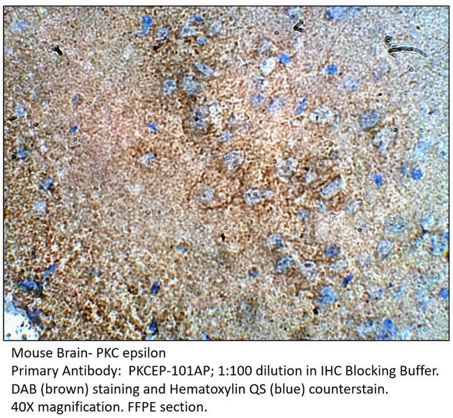 PKC epsilon Antibody in Immunohistochemistry (IHC)