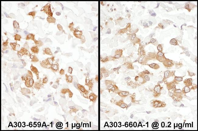 PKM2 Antibody in Immunohistochemistry (IHC)