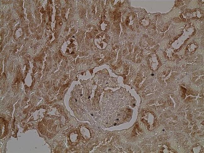 PLA2R1 Antibody in Immunohistochemistry (Paraffin) (IHC (P))