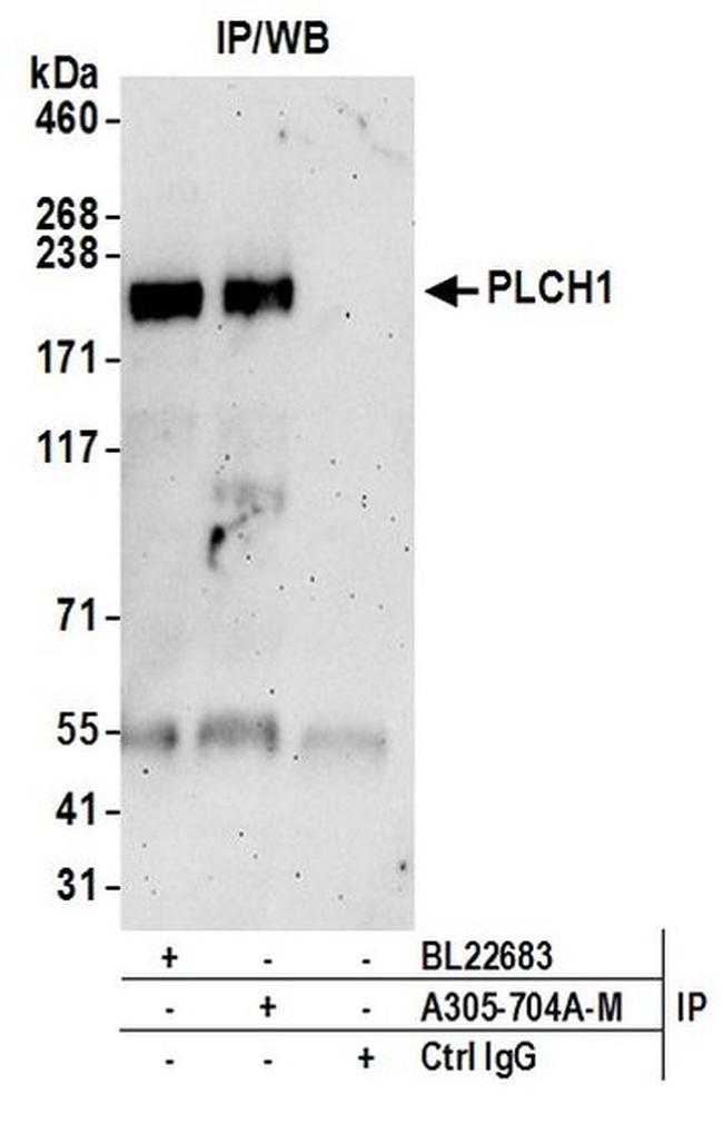 PLCH1 Antibody in Immunoprecipitation (IP)