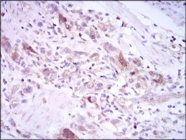 PLK1 Antibody in Immunohistochemistry (Paraffin) (IHC (P))