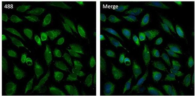 PMP70 Antibody in Immunocytochemistry (ICC/IF)