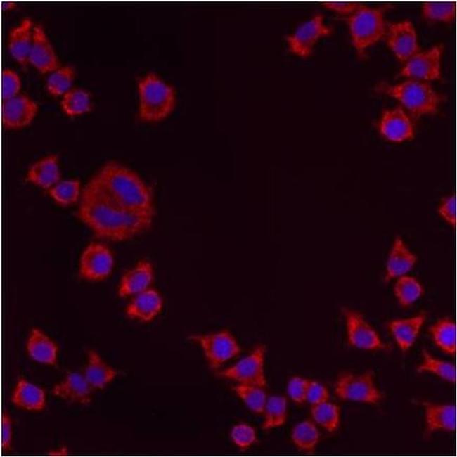 PMP70 Antibody in Immunocytochemistry (ICC/IF)