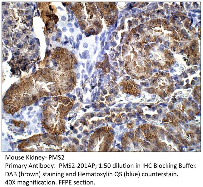 PMS2 Antibody in Immunohistochemistry (IHC)