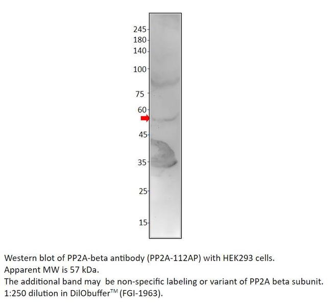 PP2A-beta Antibody in Western Blot (WB)