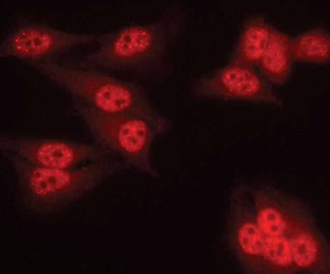 PPP2R2A Antibody in Immunocytochemistry (ICC/IF)