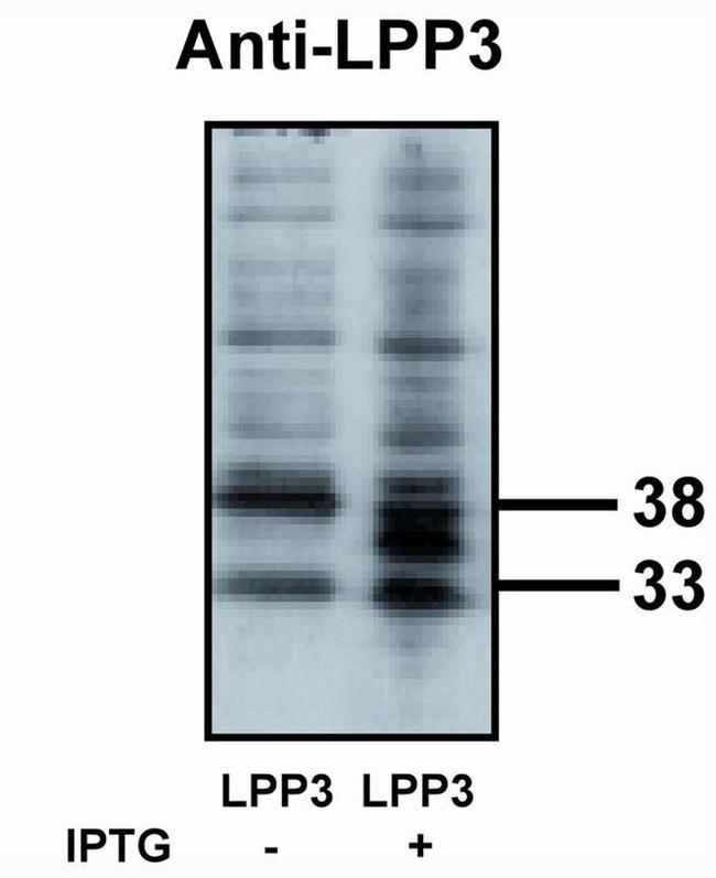 PPAP2B Antibody in Western Blot (WB)