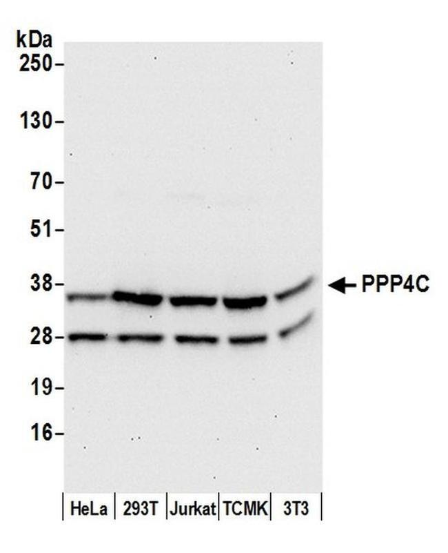 PPP4C Antibody in Western Blot (WB)