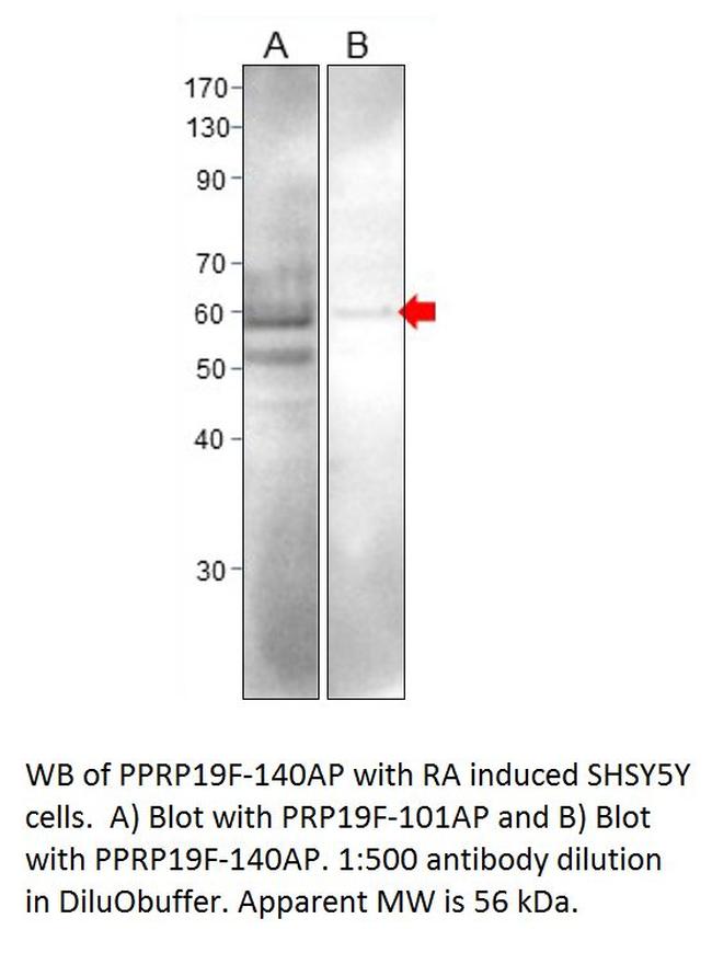 Phospho-PRP19 (Ser372) Antibody in Western Blot (WB)