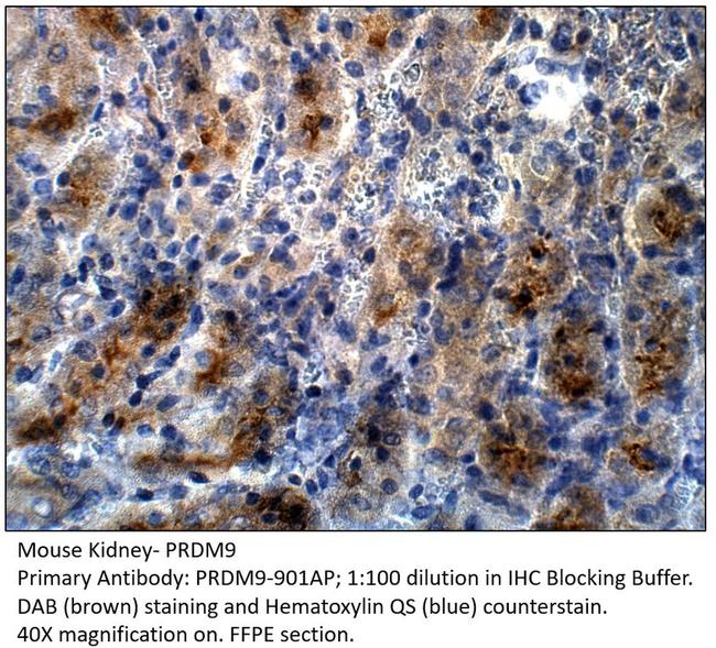 PRDM9 Antibody in Immunohistochemistry (IHC)