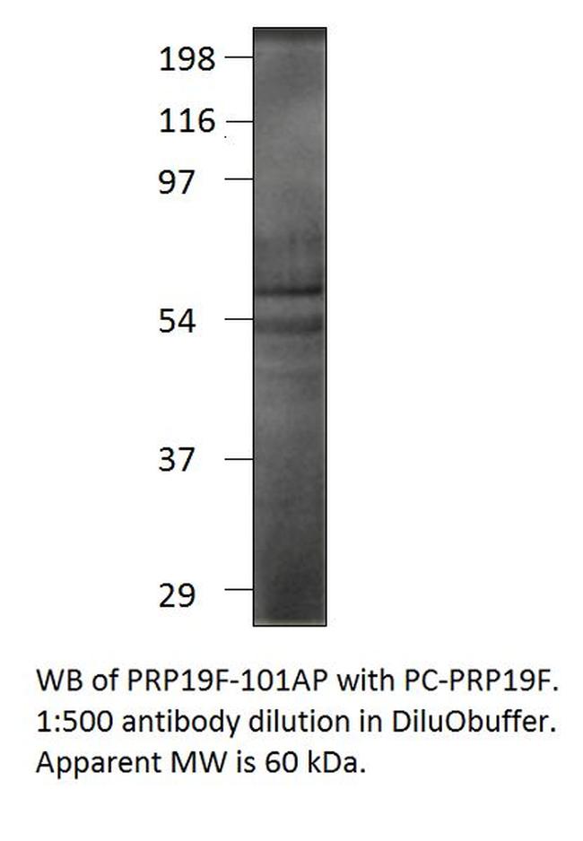 PRP19 Antibody in Western Blot (WB)