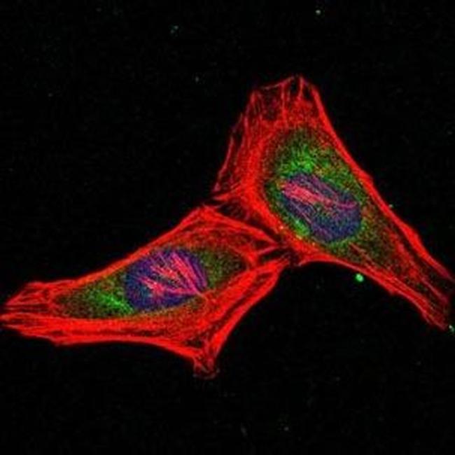 PSMB8 Antibody in Immunocytochemistry (ICC/IF)