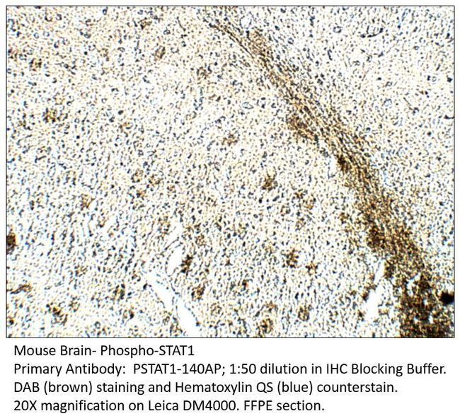 Phospho-STAT1 (Ser727) Antibody in Immunohistochemistry (IHC)