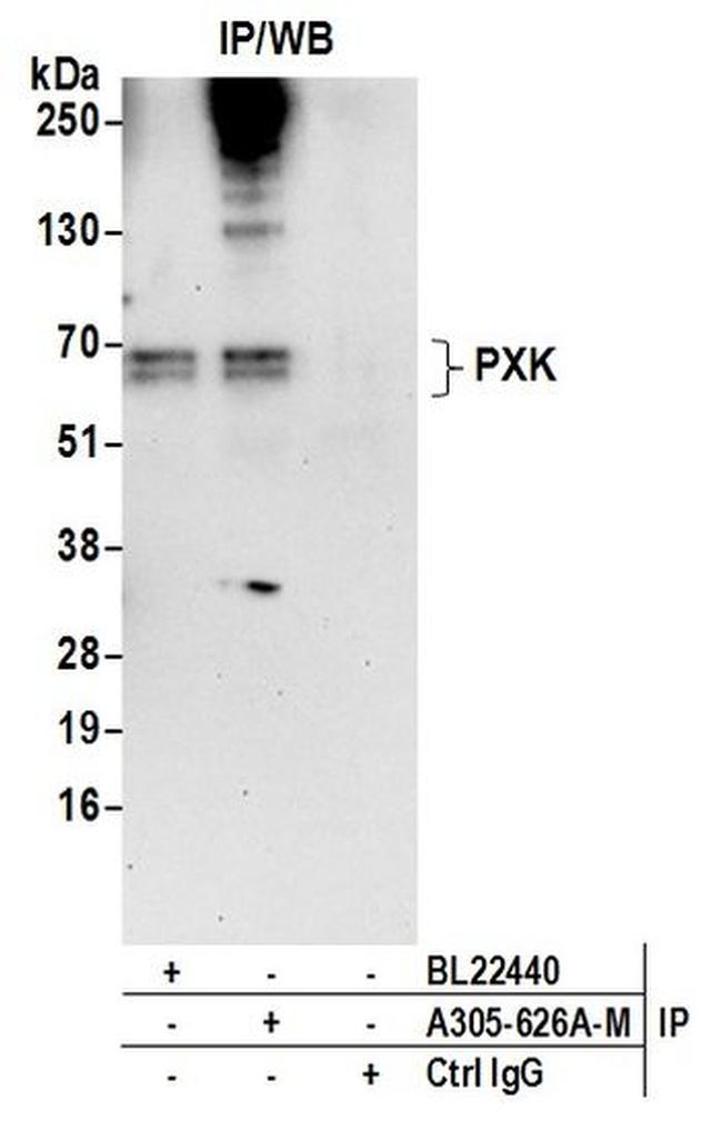 PXK Antibody in Immunoprecipitation (IP)