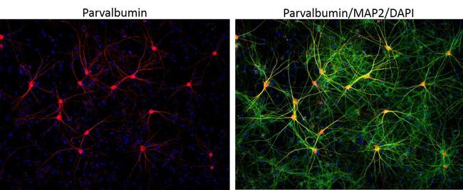 Parvalbumin Antibody in Immunocytochemistry (ICC/IF)