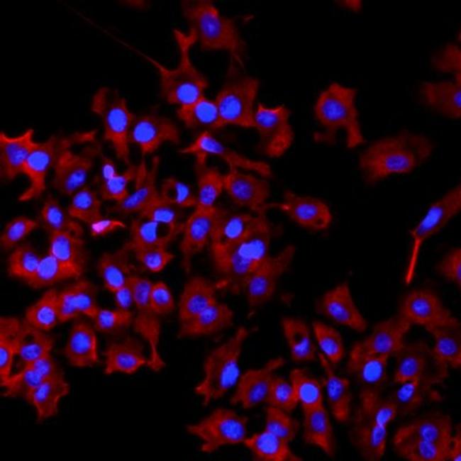 Perilipin 1 Antibody in Immunocytochemistry (ICC/IF)