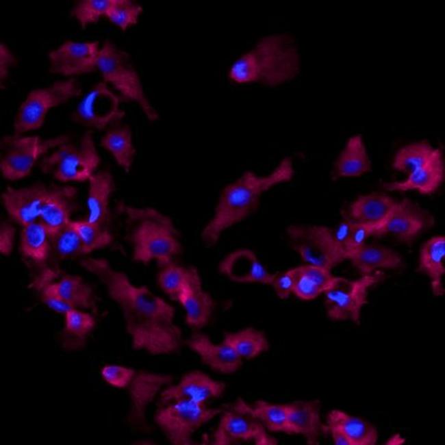 Perilipin 1 Antibody in Immunocytochemistry (ICC/IF)