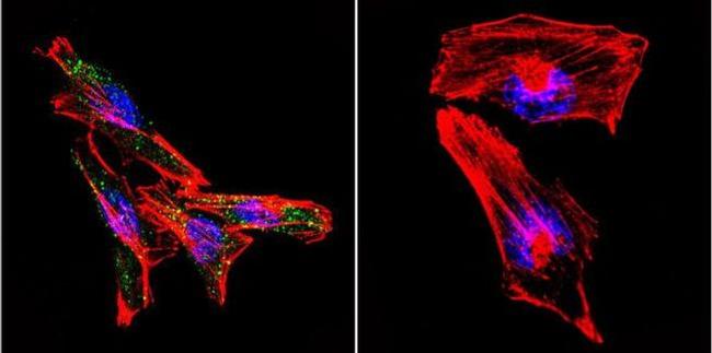 PSEN2 Antibody in Immunocytochemistry (ICC/IF)